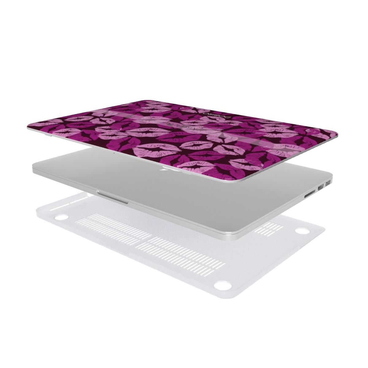 MacBook Case
