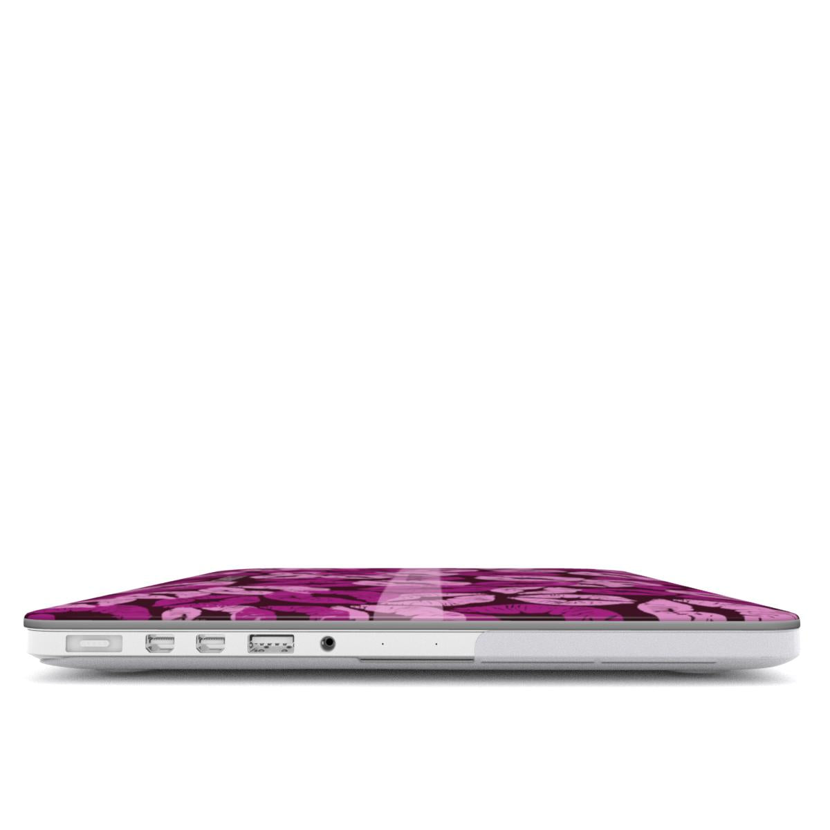 MacBook Case