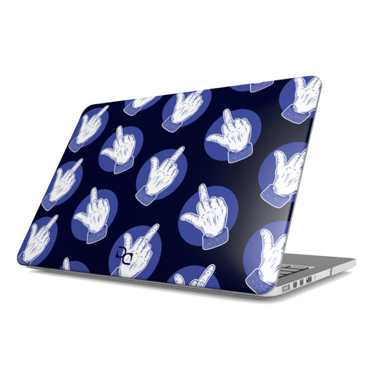 MacBook Case