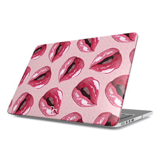 MacBook Case