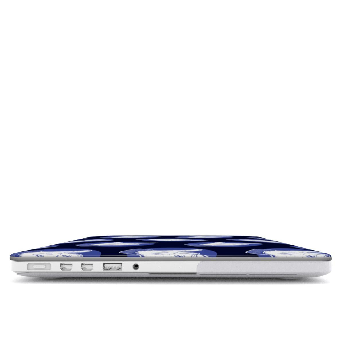 MacBook Case
