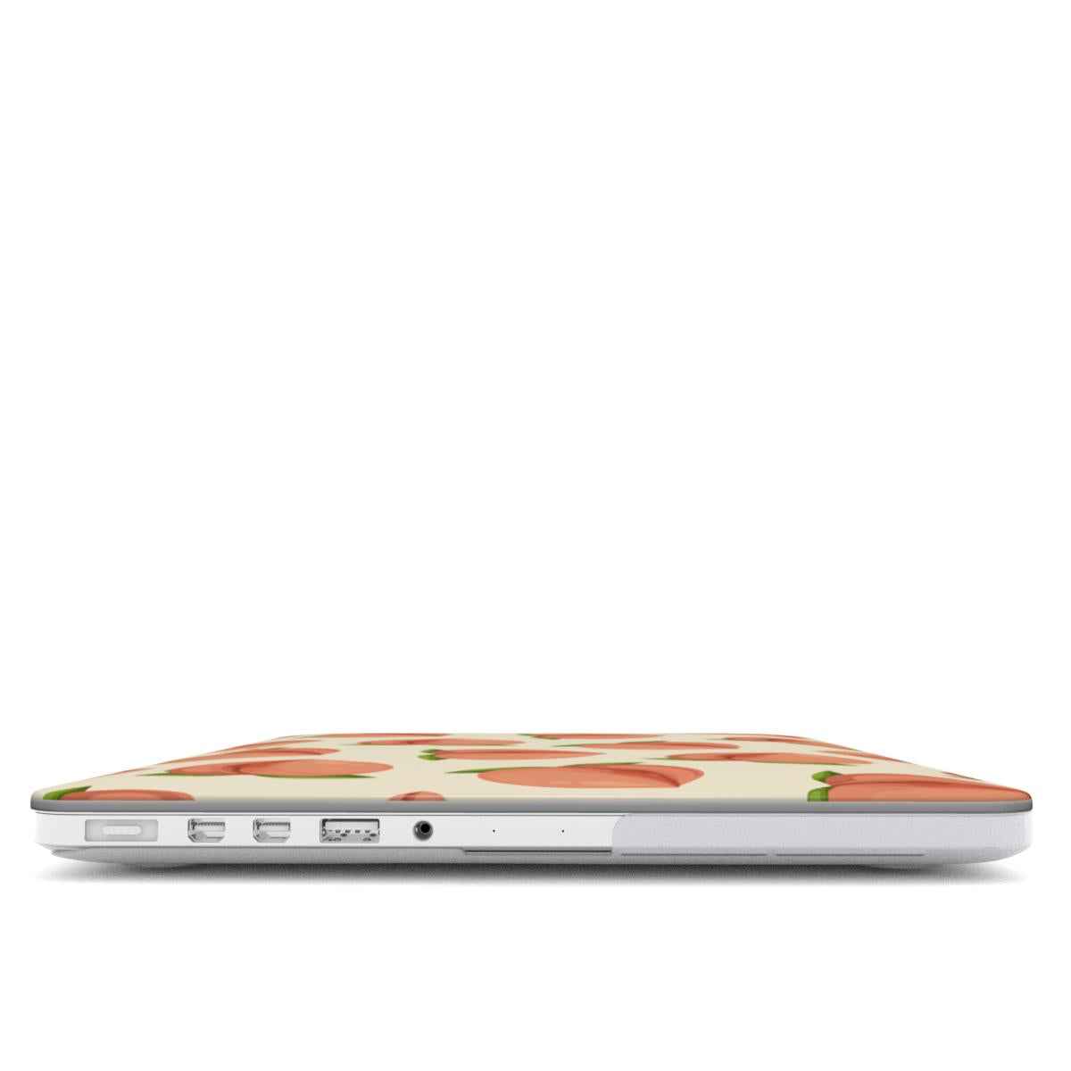 MacBook Case