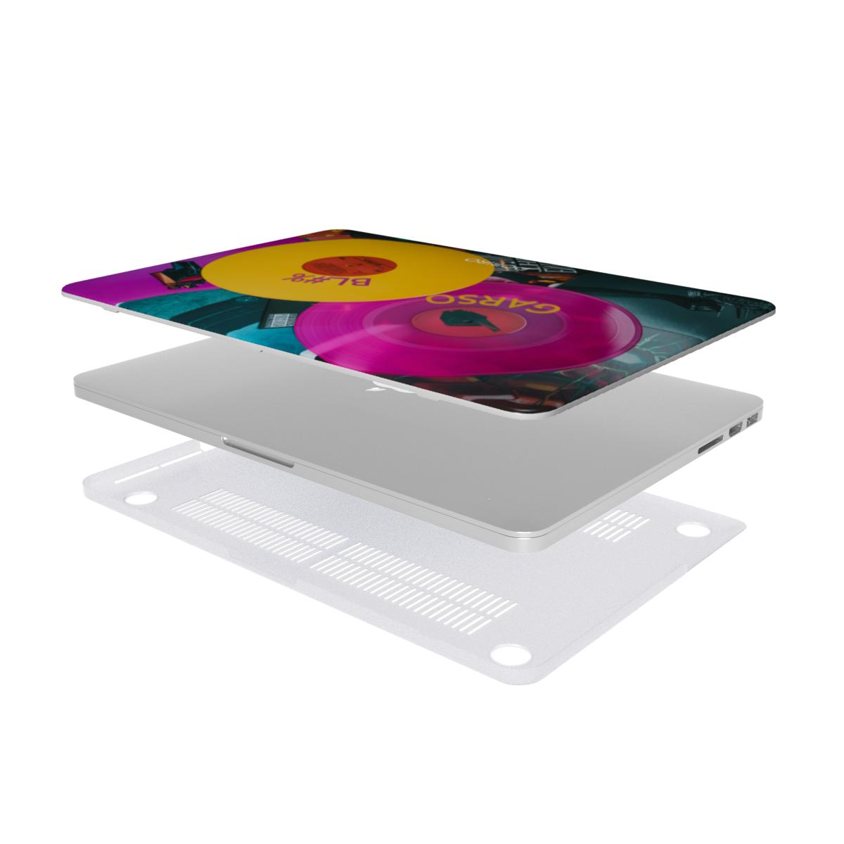 MacBook Case